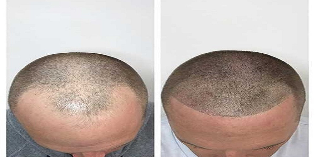 How to Prevent Hair Damage in Young Children: A Parent’s Guide