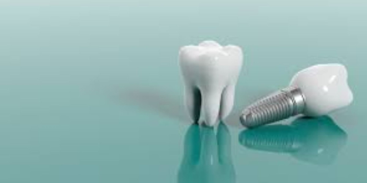 Dental Implants vs Dentures: Choosing the Right Long-Term Solution for Missing Teeth