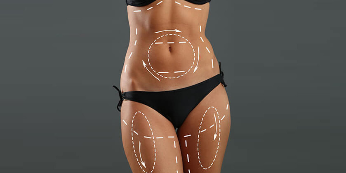 The Psychological Impact of Liposuction: Confidence and Body Image