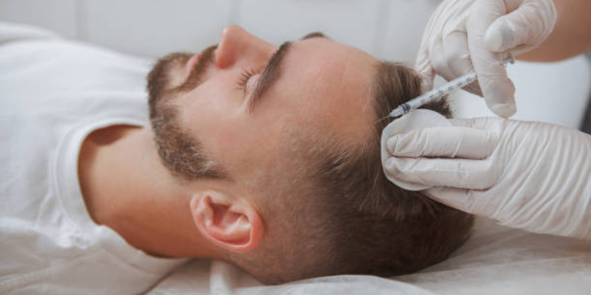 Myths and Facts About Hair Transplant Procedures