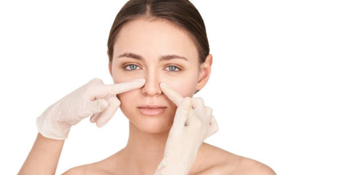 Profile Rhinoplasty Perfection: Side View Transformations Detailed