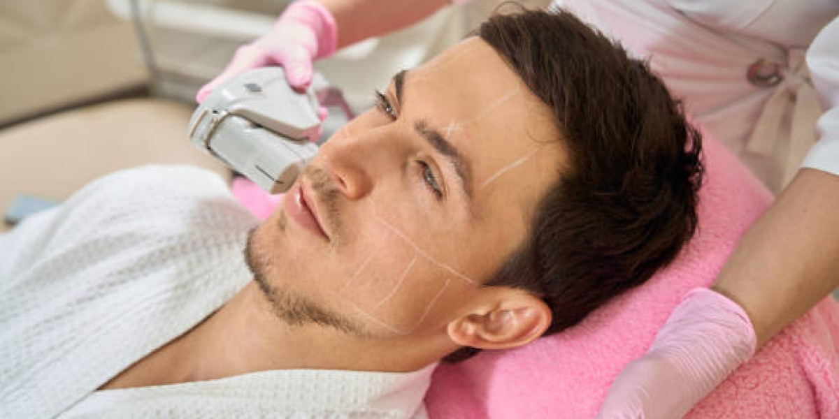 Pico Laser Treatment for Melasma: Results in Riyadh Explained