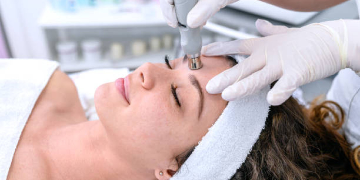 Combining Hydrafacial with Chemical Peels?