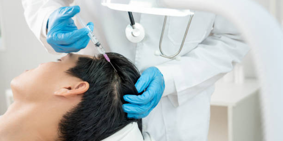 How Many PRP Sessions for Hair Growth?