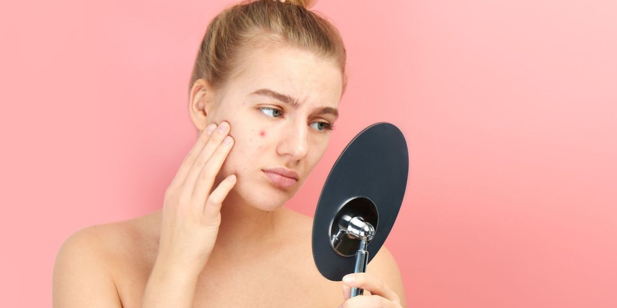 Contemporary Acne Procedures Using Proven Techniques