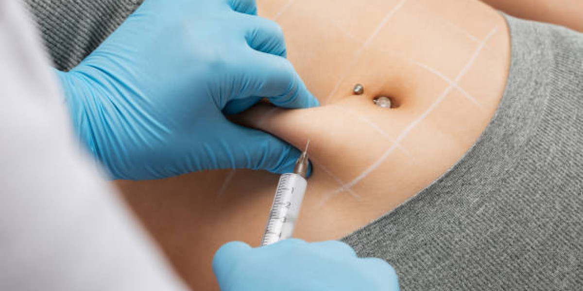 Targeted fat dissolving injections for problem areas