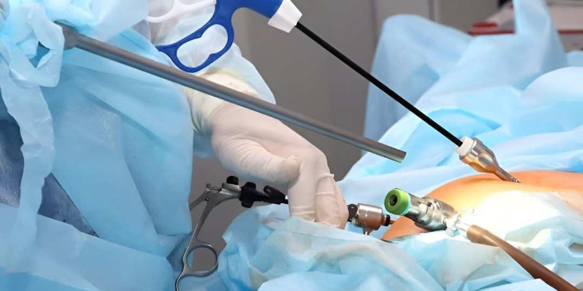 Precision Experts Laparoscopic Surgery in Islamabad