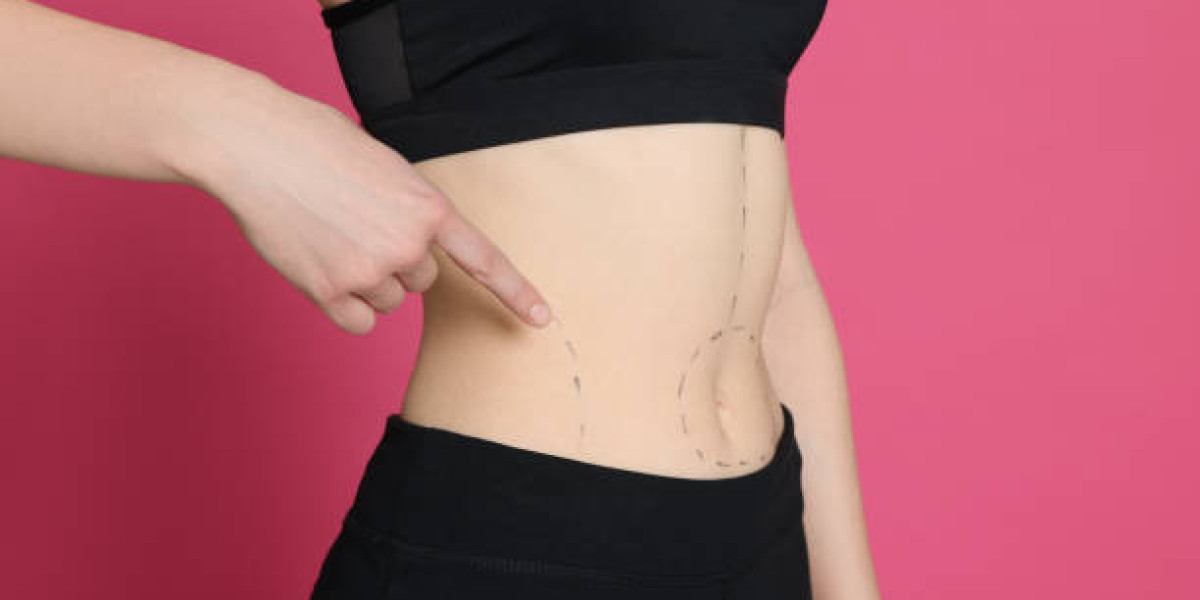 Liposuction Procedure for Men: Does It Work Well?