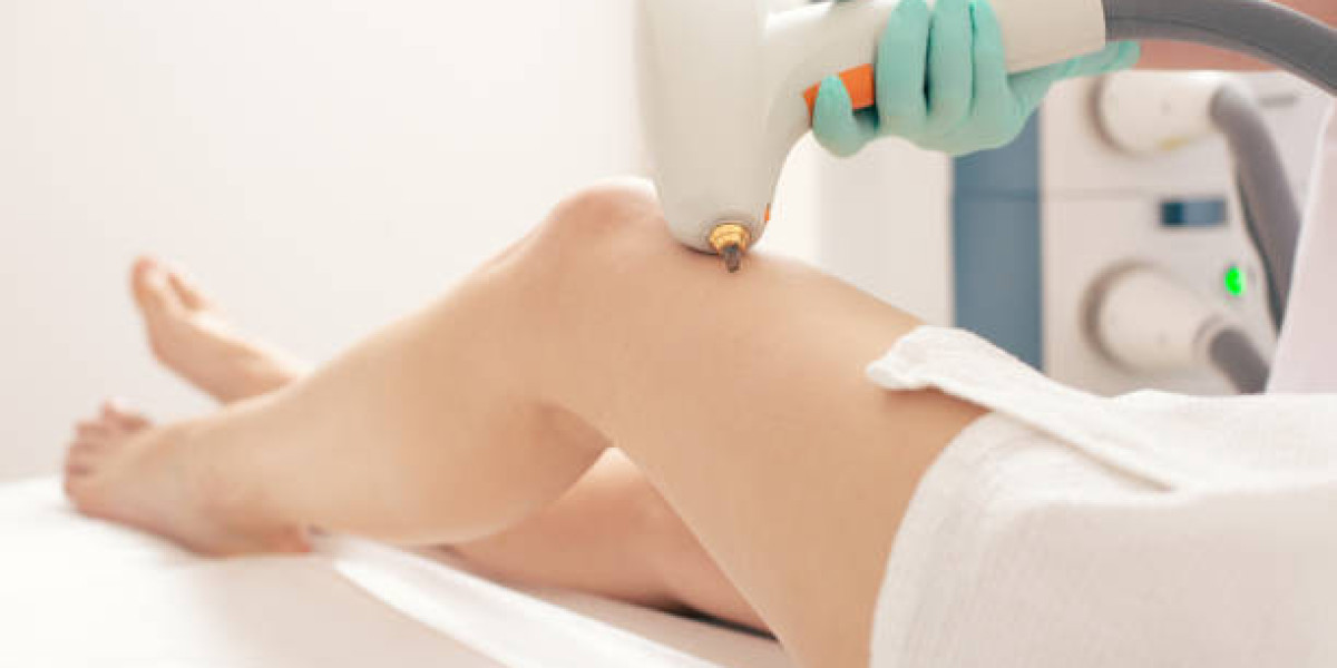 Laser Hair Removal for Indian Skin Tones: Tailored Advice