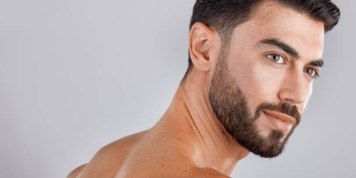 Beard Hair Transplant for Filling Sparse Cheeks