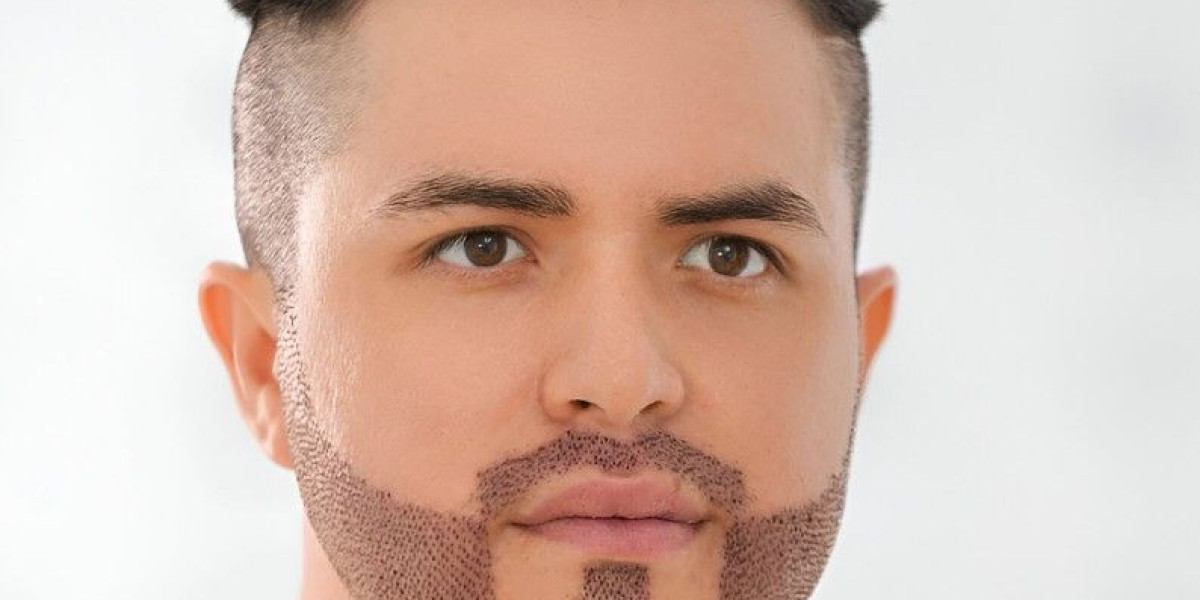 Is Beard Transplant Worth It in Islamabad? Real Results