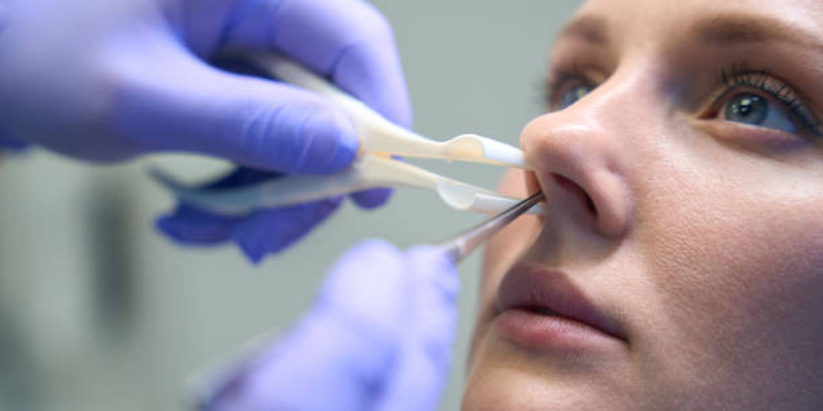 How to Ventilate Post-Rhinoplasty?