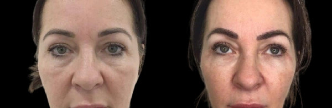 Skincare treatments