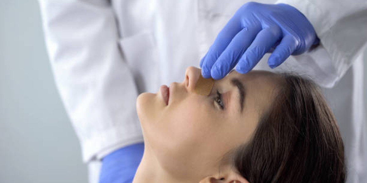 كيف تؤثر عملية تجميل الأنف على التوازن الجمالي للوجه