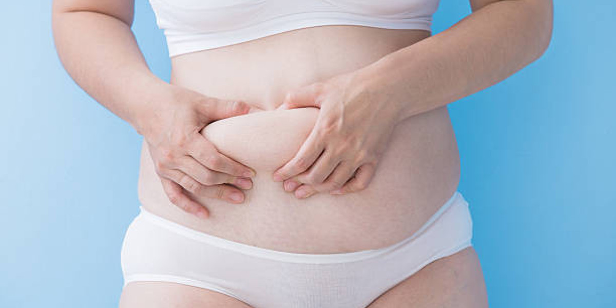 Travel After Tummy Tuck Surgery: When It's Safe to Fly Again