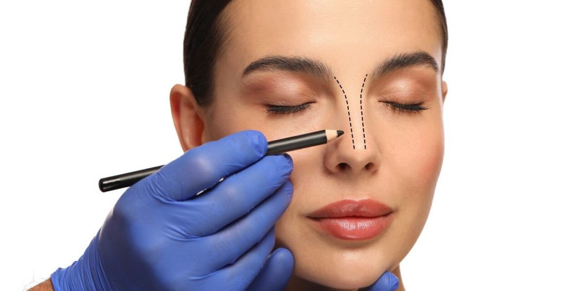 Benefits of Rhinoplasty for Facial Harmony