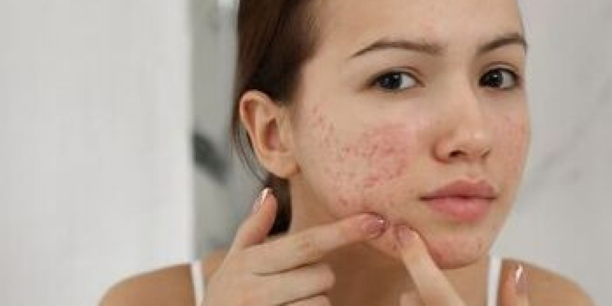 Pigmentation Treatment That Actually Shows Results