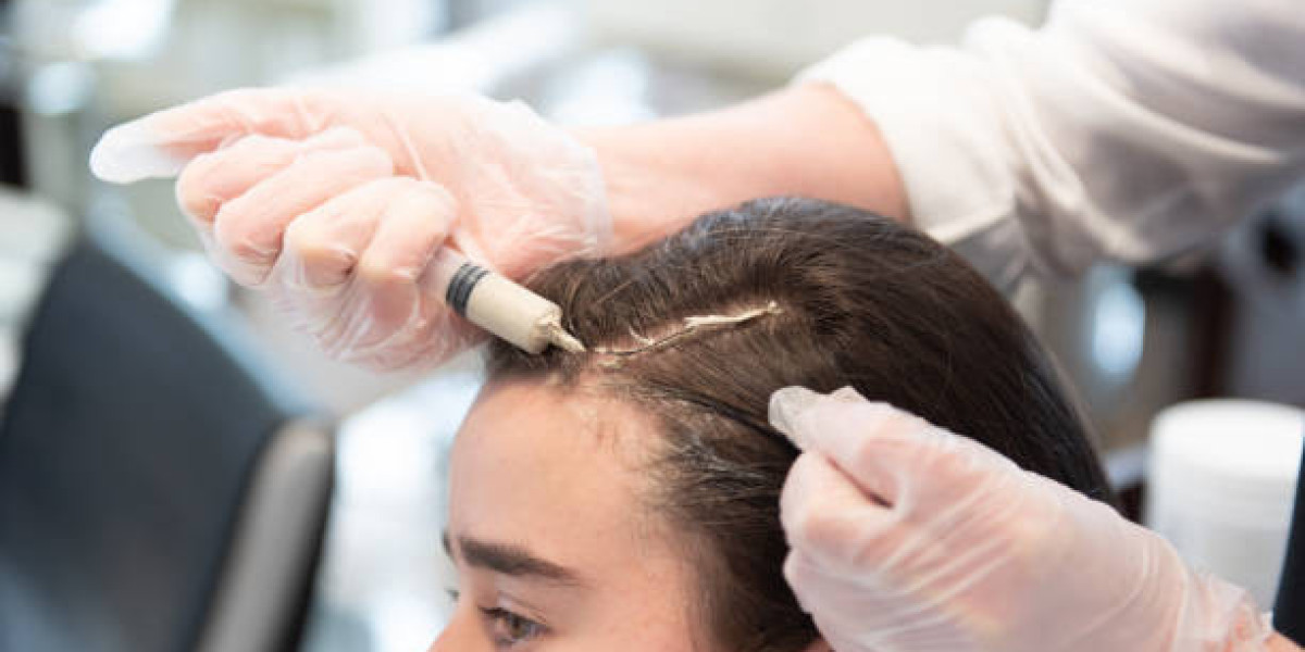 Can PRP Hair Treatment Thicken Thin Hair?