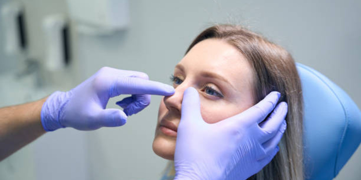 Revision Rhinoplasty: When Needed?