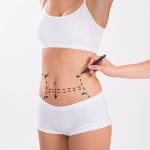 Liposuction procedure in Riyadh