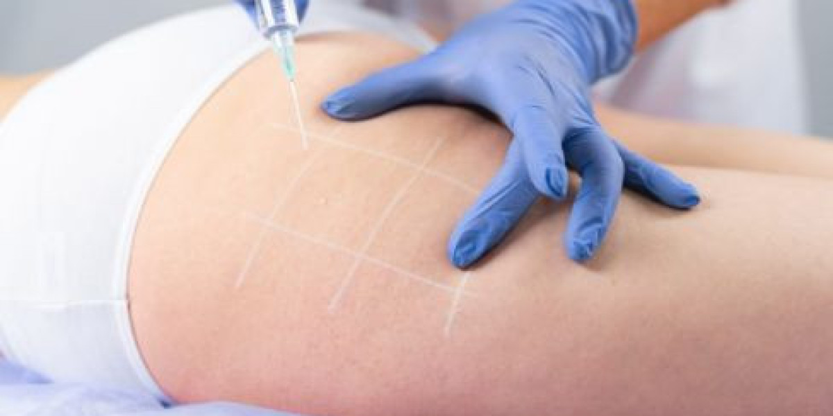 Get a Natural Look with Modern Butt Body Fillers