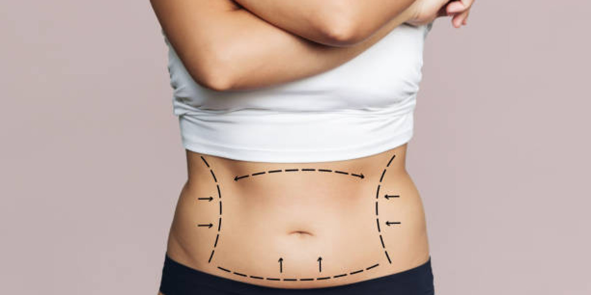 What Are the Main Types of Liposuction?