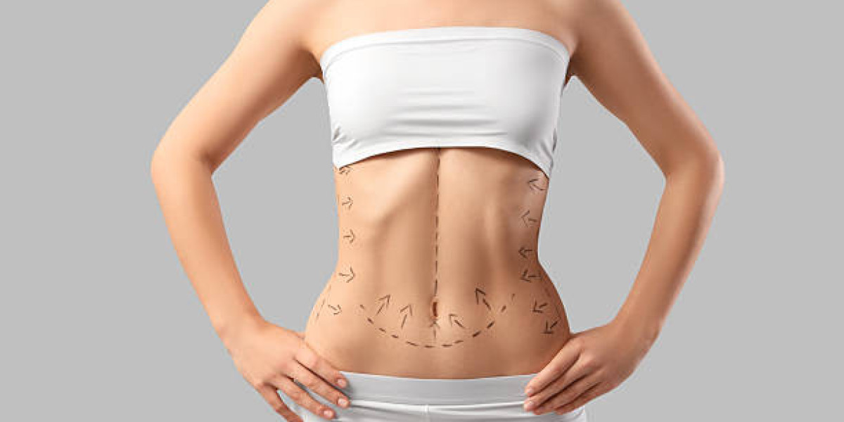 How Post-Surgery Care Impacts Liposuction Results Long-Term