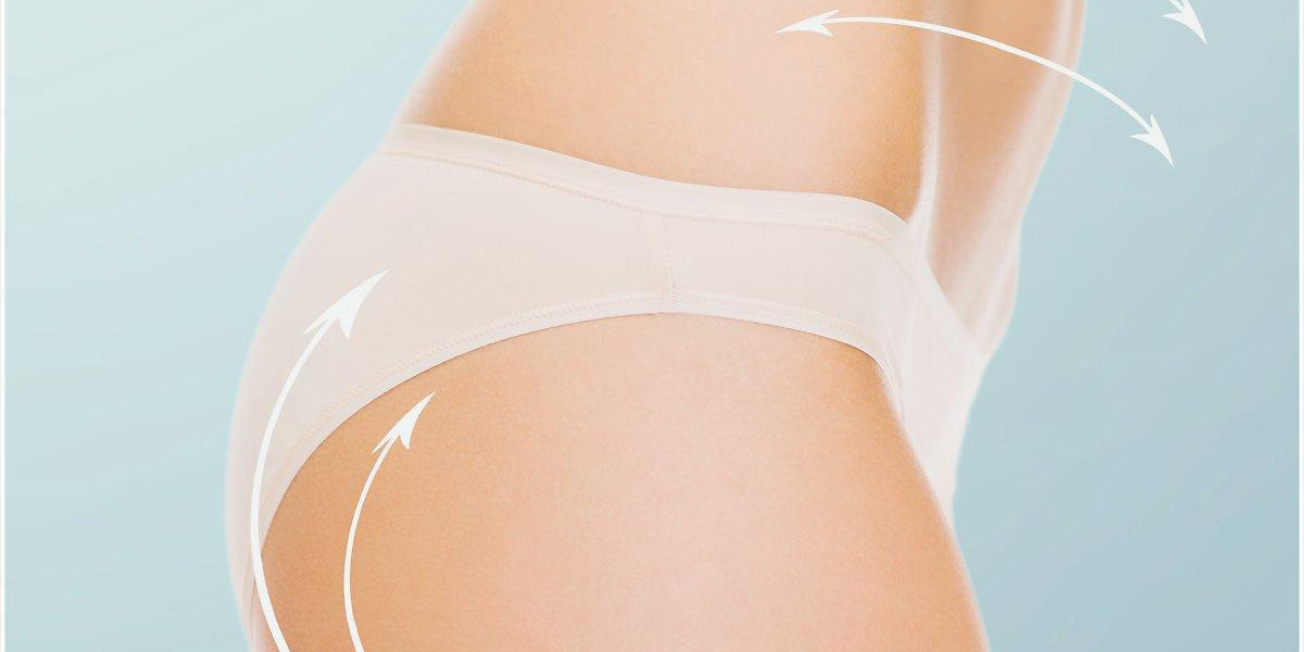 Liposuction in Riyadh: Ideal for Stubborn Fat Removal