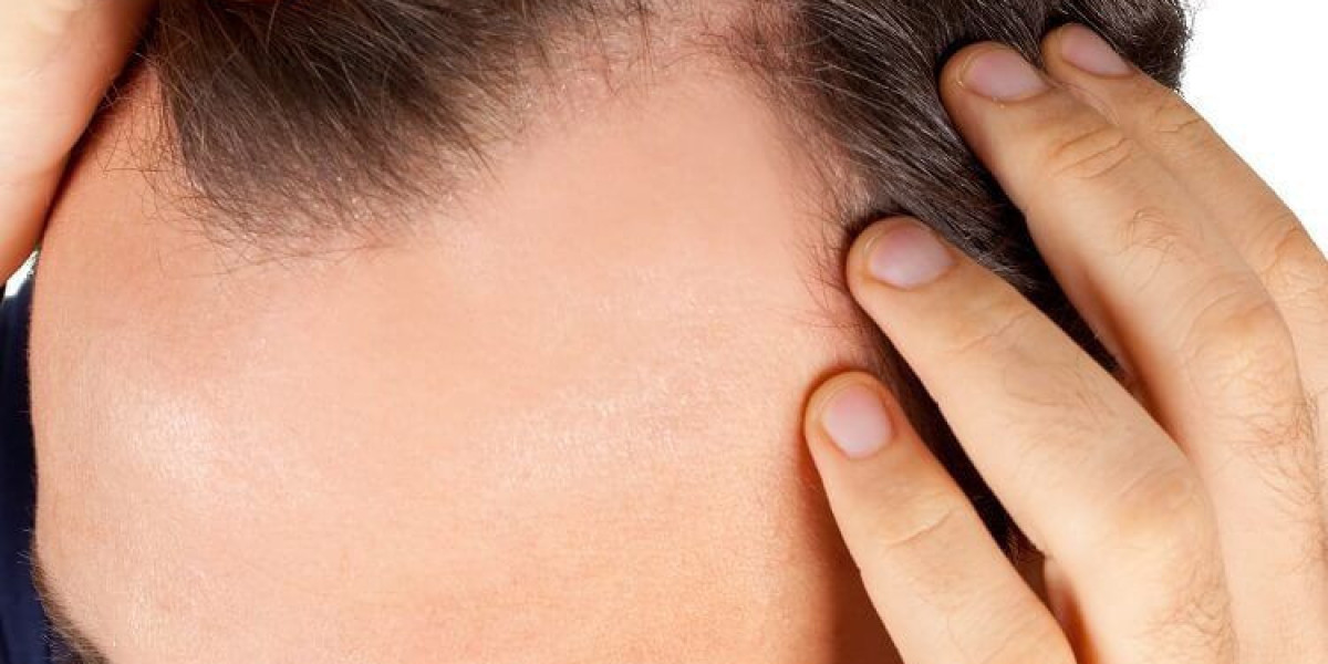The Ultimate Hair Revival Experience