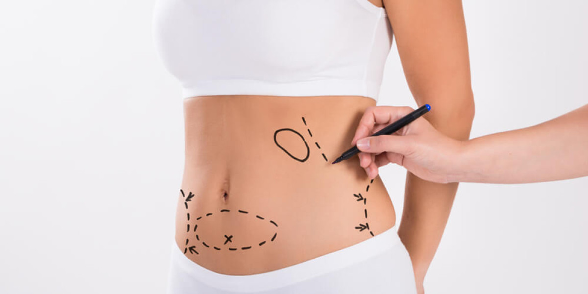 How Do Different Techniques Affect Liposuction Cost in Dubai?