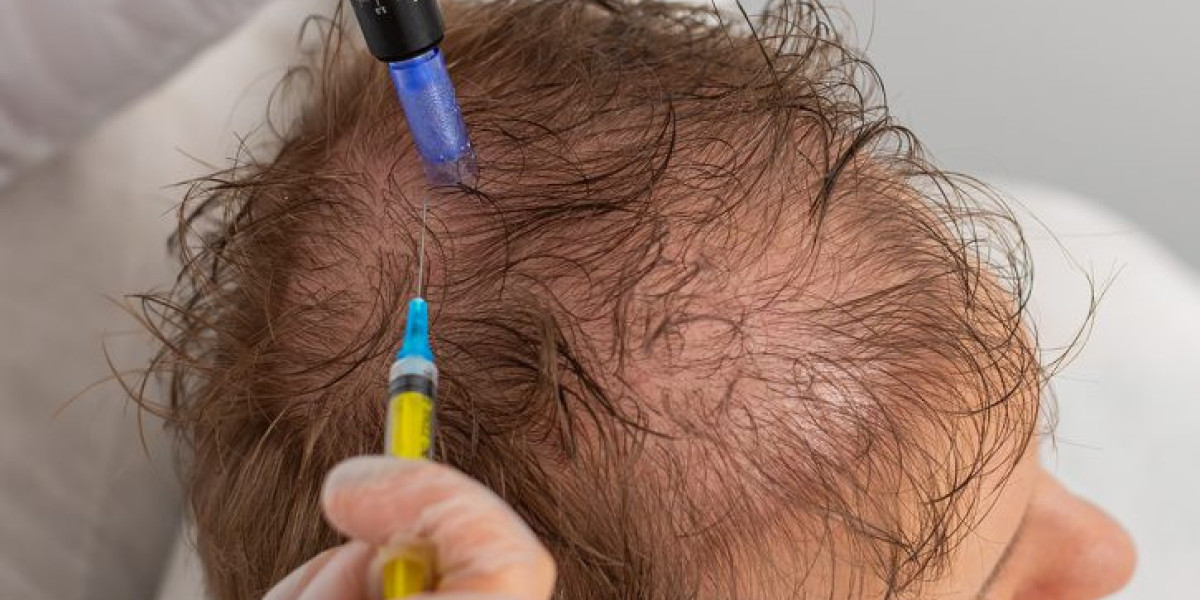 Exosomes Hair Therapy in Islamabad for Long-Lasting Results