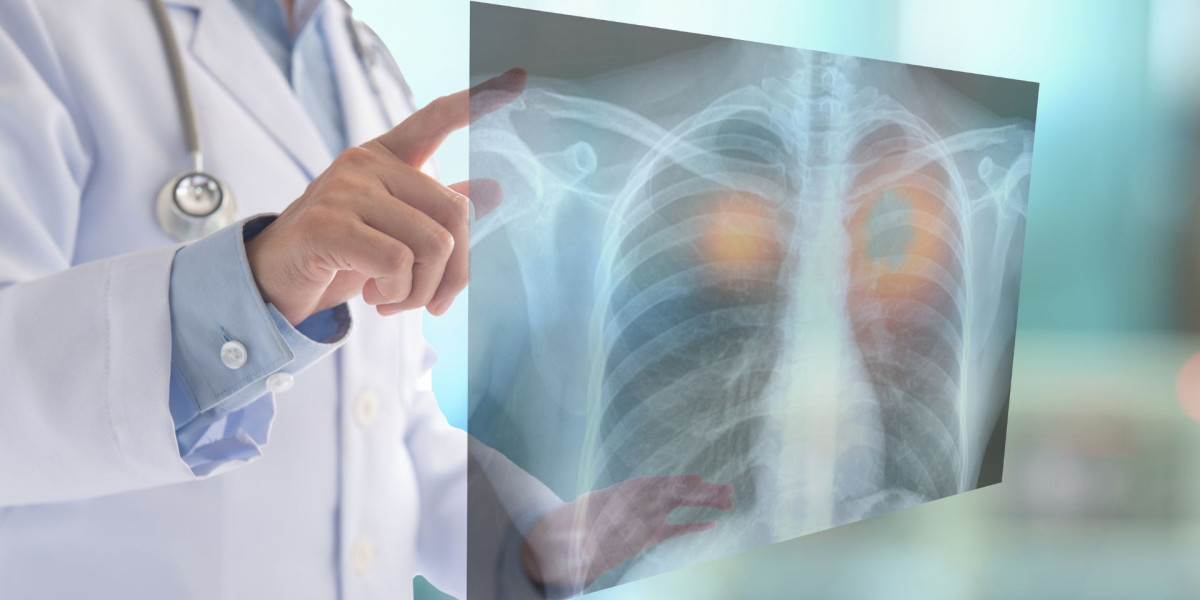 Handheld X-Ray Market Surges Toward $1.82B as Portable Diagnostics Rise