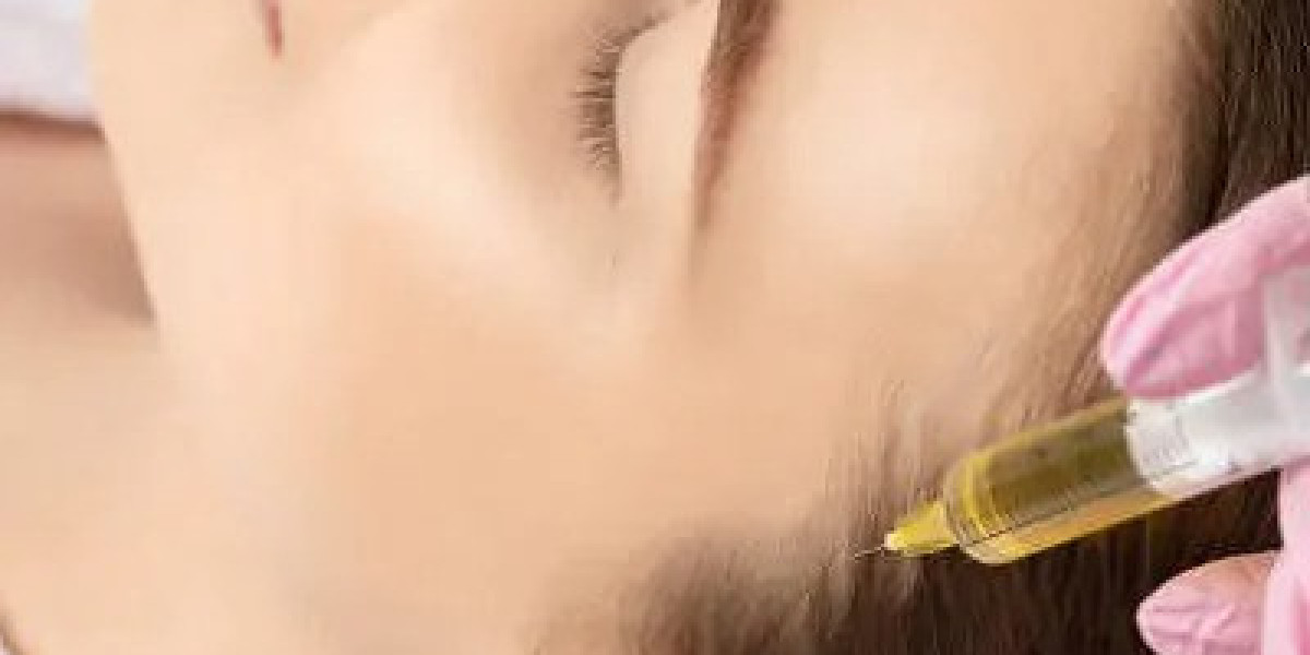 PRP Hair Treatment in Islamabad – Restore Healthy Hair with Enfield Royal Clinic