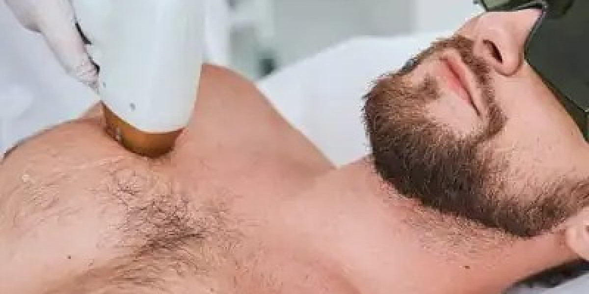 Laser Hair Removal in Islamabad – A Reliable Solution for Unwanted Hair at Enfield Royal Clinic