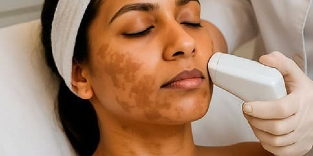 Dermal Pigmentation in Islamabad for Skin Perfection