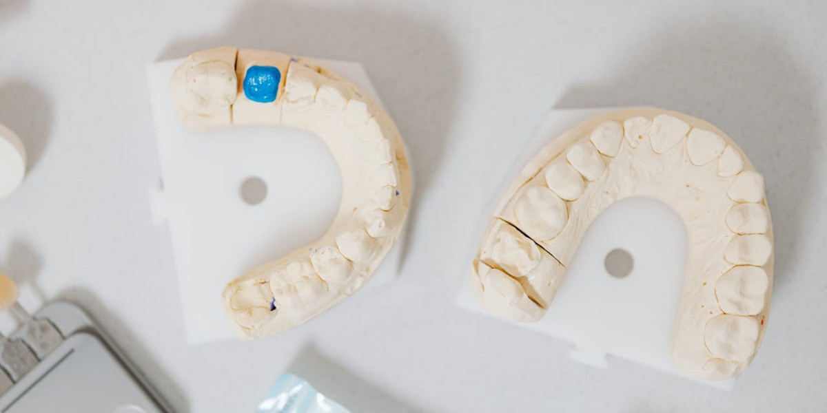 Common Coverage Gaps In Standard Dental Insurance For Braces