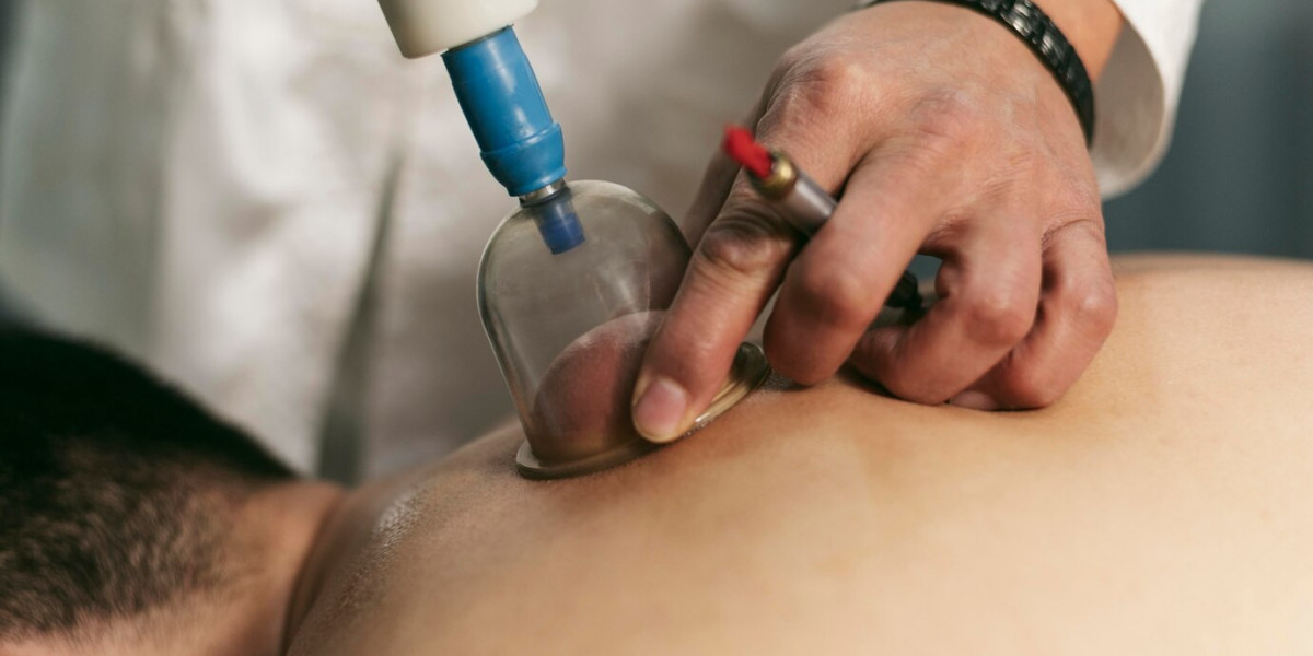 Hijama Treatment Cost and Session Duration Explained