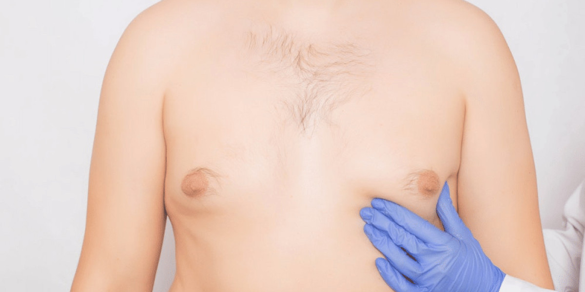 Long-Term Results of Gynecomastia In Islamabad