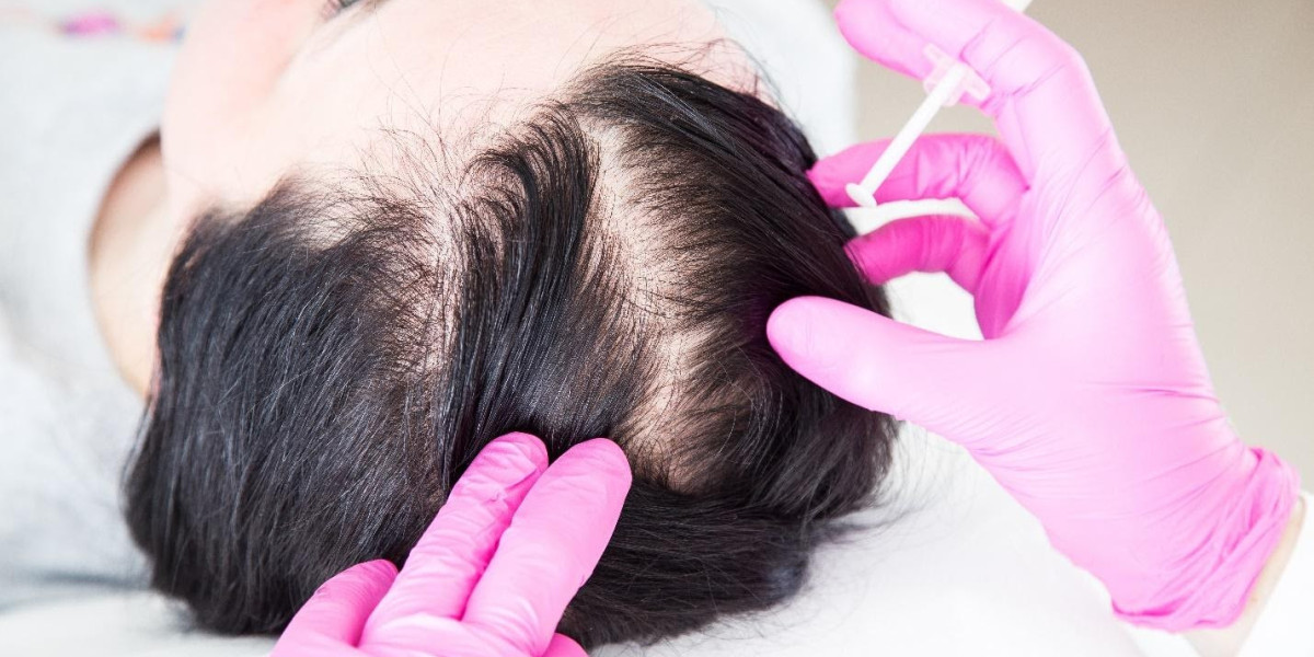 Best Hair Loss Treatment in Islamabad – Enfeild Royal Clinic