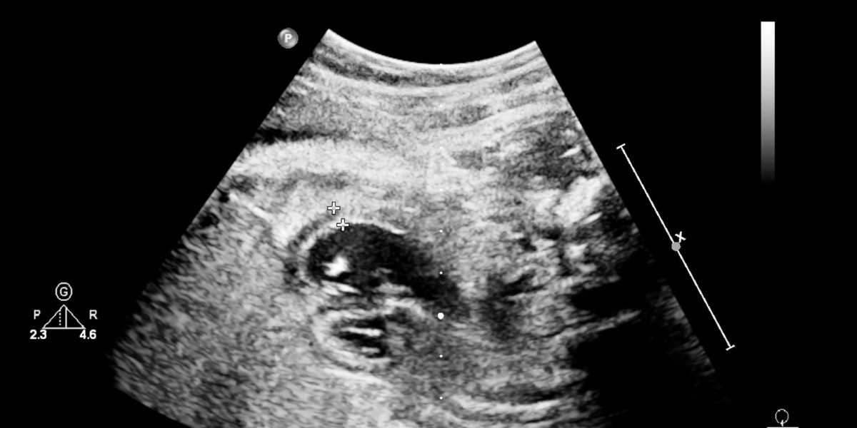 Endobronchial Ultrasound Biopsy Market Set for Steady Growth Through 2033