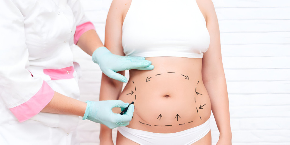 Bariatric Surgery: A Lifelong Solution to Obesity