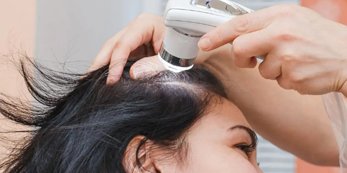 Regenera Activa next generation healing approach fuller looking hair volume
