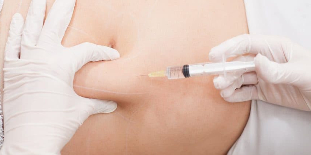 Are Fat Dissolving Injections Safe? Expert Insights