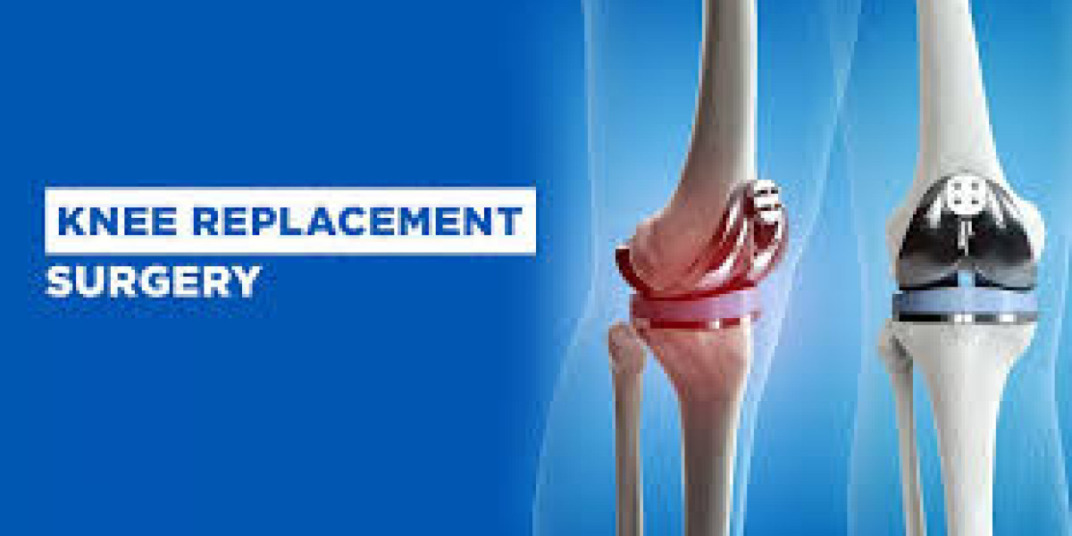 Sports Injury Specialist in Agra: Finding the Right Care for Faster Recovery