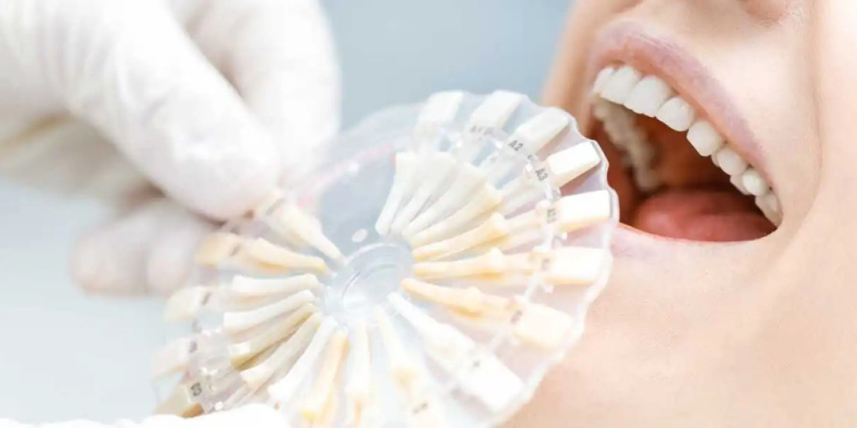 Understanding Teeth Whitening Cost: A Complete Guide by Afflux Dentistry