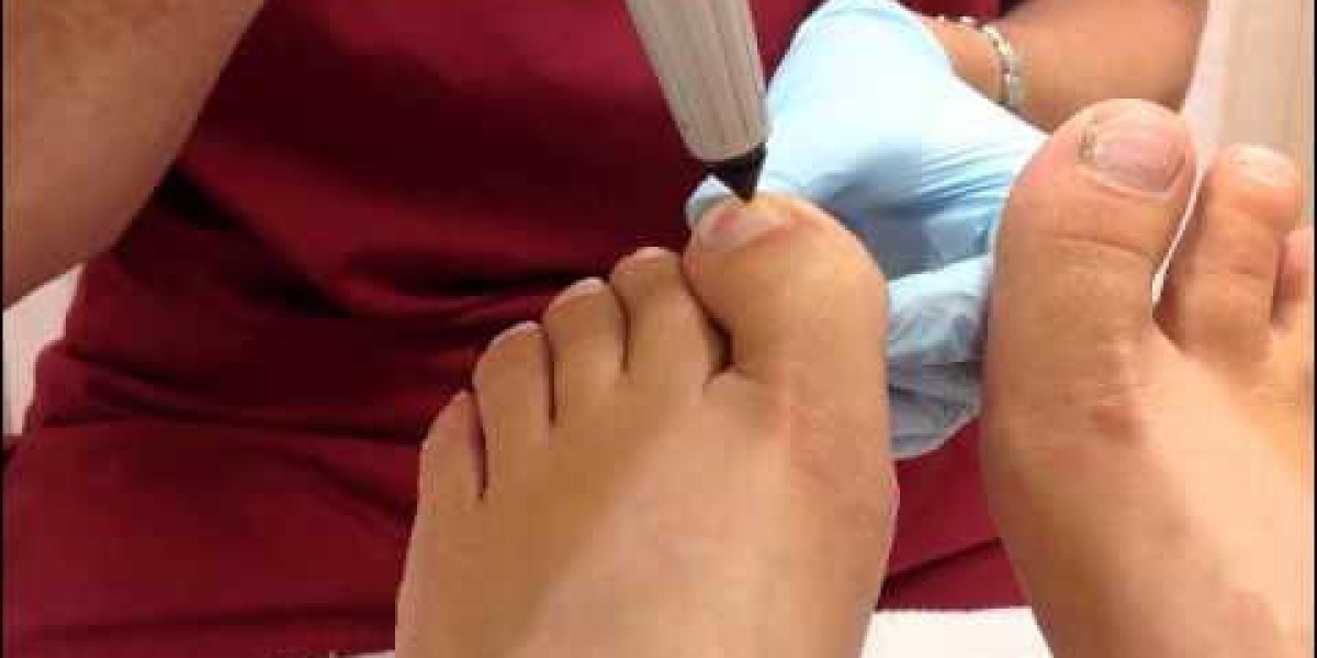 Vegan and Cruelty-Free Nail Reconstruction in Edinburgh City