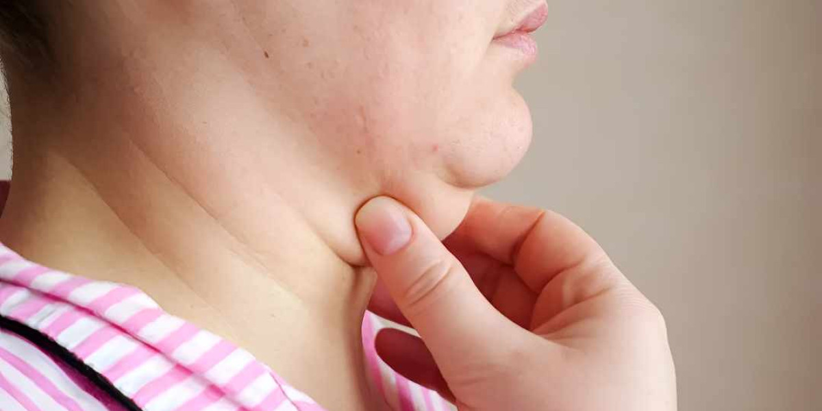Best Results Double Chin Liposuction in Islamabad