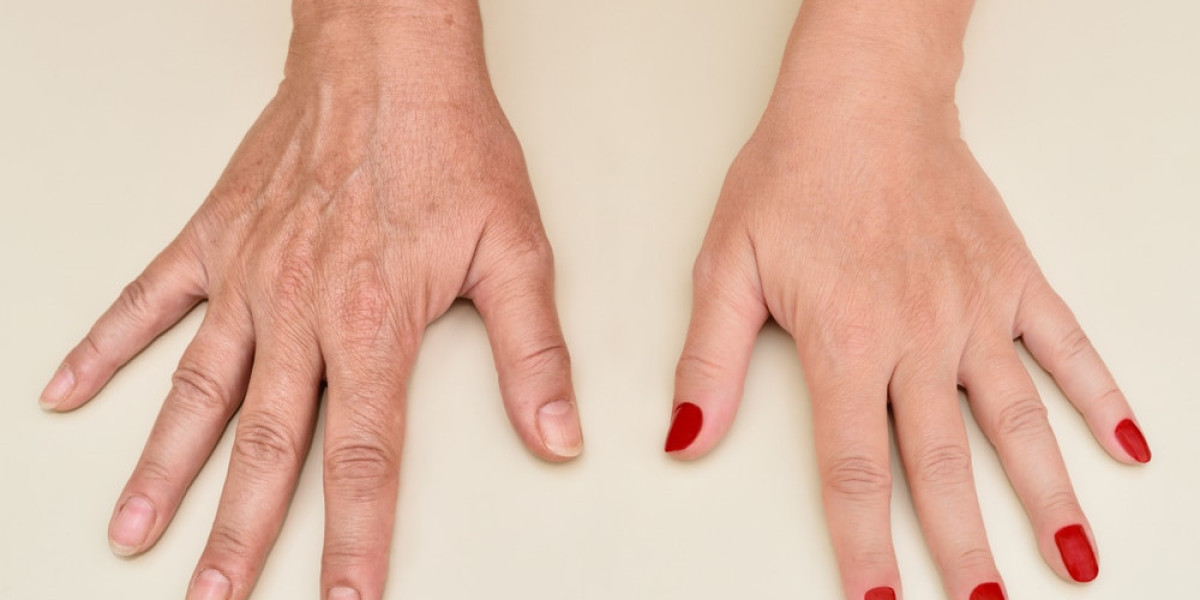Hands Renewed Naturally: Soft, Smooth, and Ageless