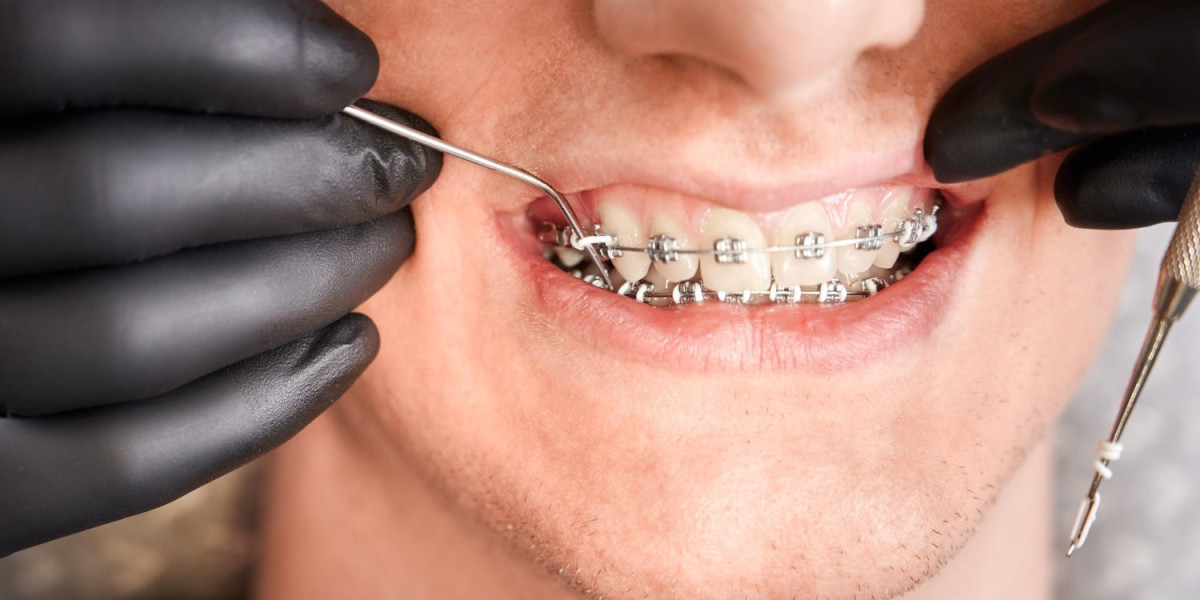 Why Regular Dental Tooth Filling in Dubai Is Important?