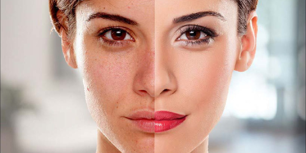 Best Skin Whitening Oils in Islamabad